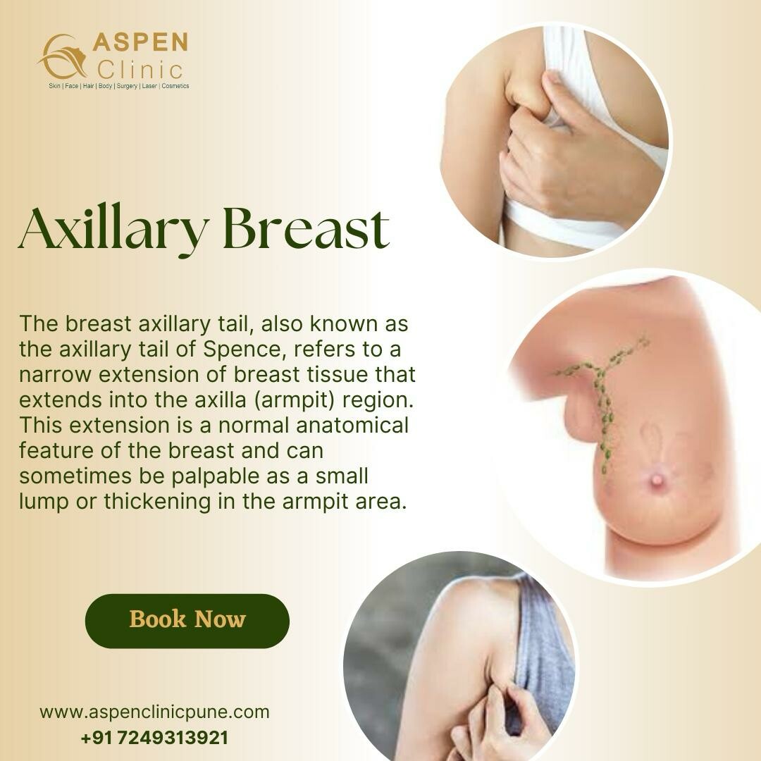 Breast Axillary Tail - Dr. Hina Khan