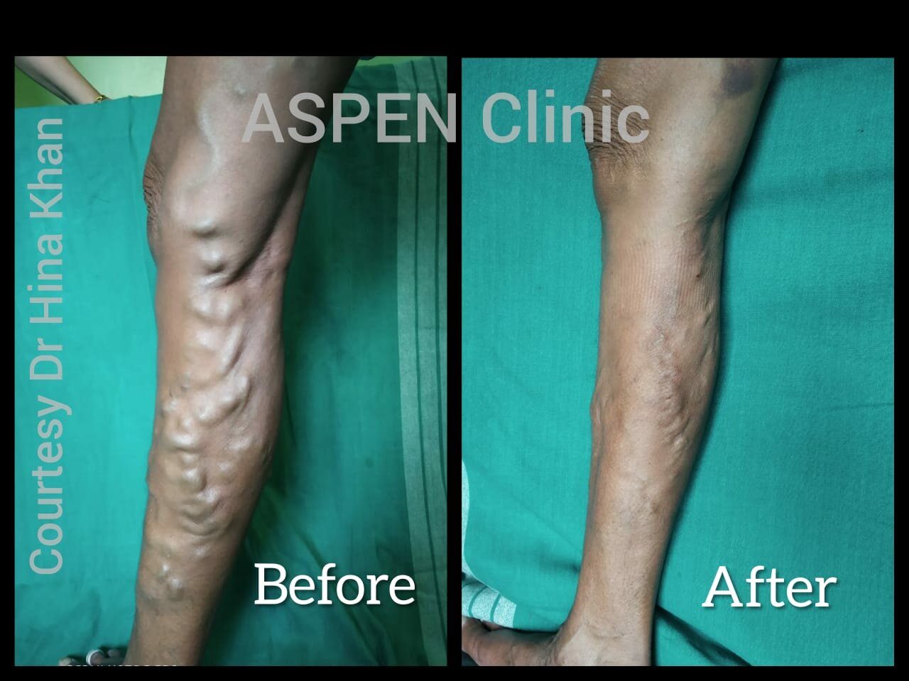 ASPEN Clinic|NIBM Post Office Rd,Pune